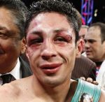 隻眼の魔術師/（マグニフィコ）イスラエル・バスケス